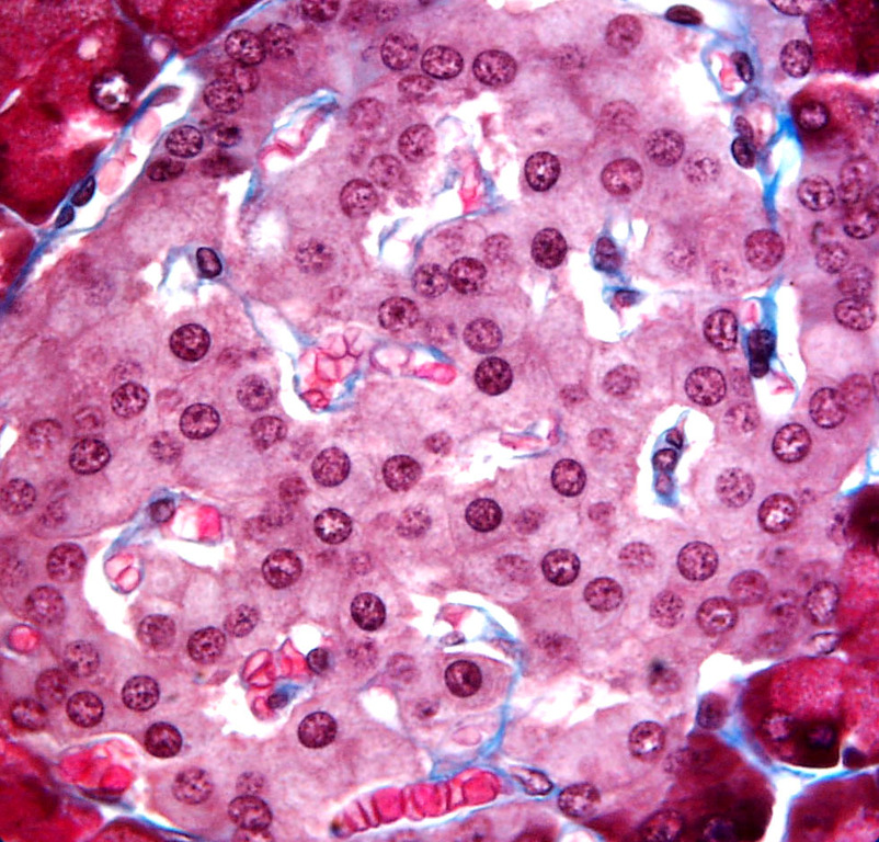 Cellules de couleur rose d'une glande endocrine
